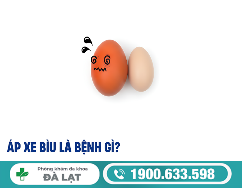 Hình ảnh minh họa